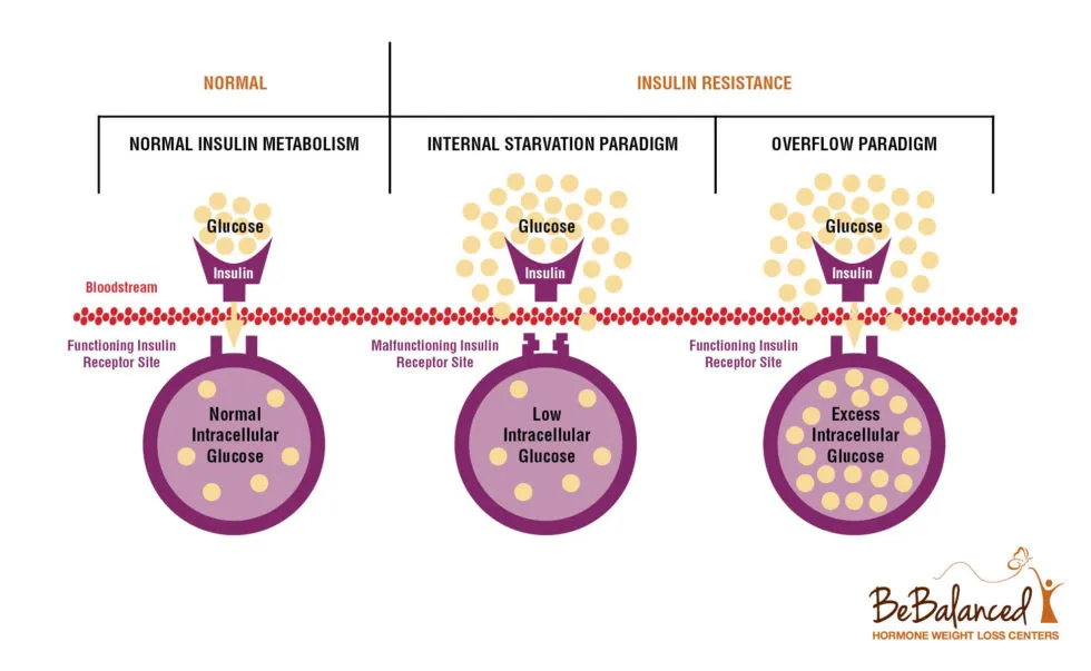 graphic of how insulin works - to assist in explaining natural ways to reduce insulin resistance